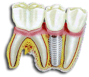 Link zu www.implantate.com